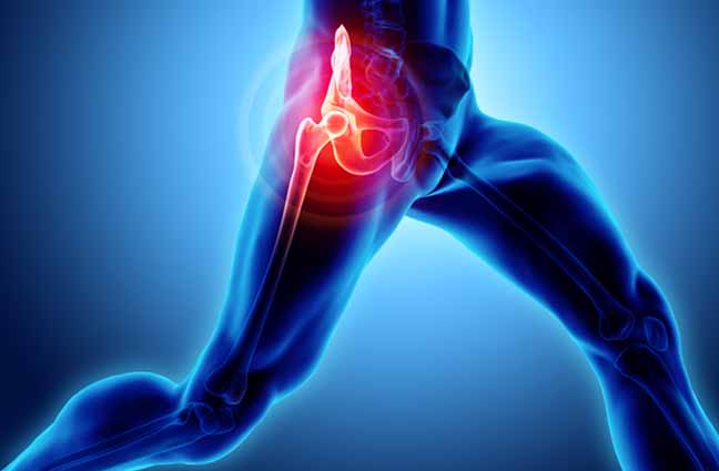 joint replacement in Dharamshala